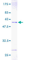 12.5% SDS-PAGE Stained with Coomassie Blue.
